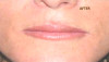 Patient # 54369 After Photo # 4