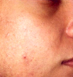 Patient # 85784 After Photo # 2