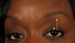 Patient # 81391 After Photo # 2