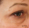 Patient # 12333 After Photo # 4
