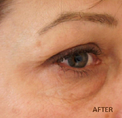 Patient # 12333 After Photo # 2