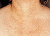 Patient # 62369 After Photo # 4