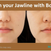 Happy Birthday to one of our Team ; Me! – Porchia! CHEEK REJUVENATION