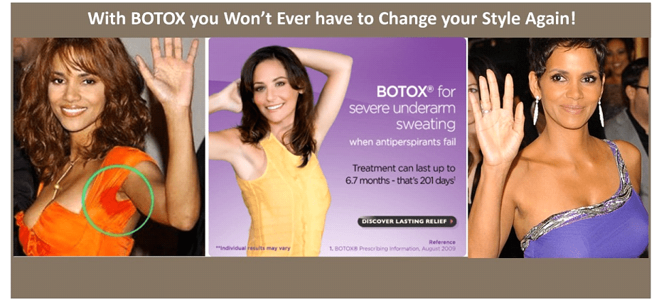 Excessive Sweating Treatment Plano TX