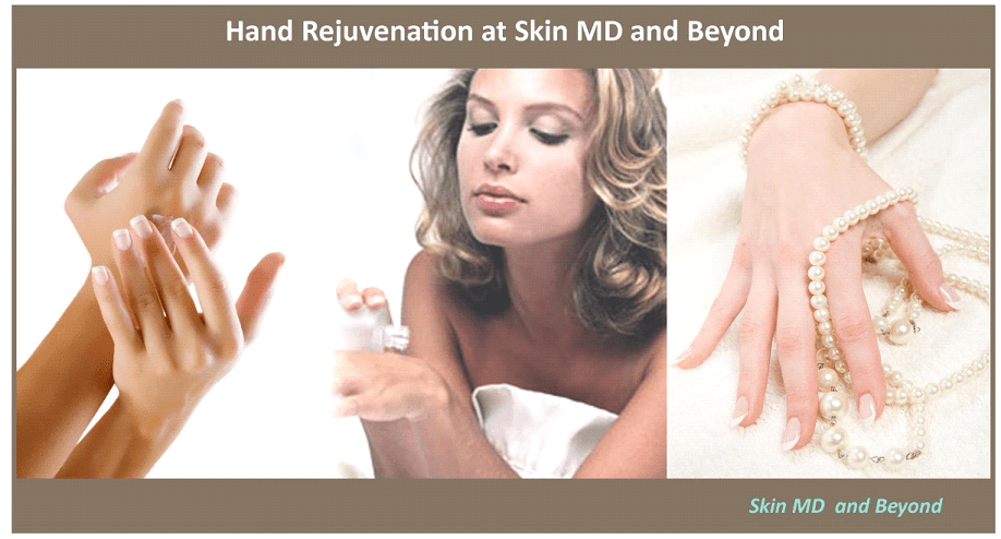 Hand Rejuvenation