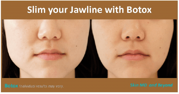 JAWLINE CONTOURING