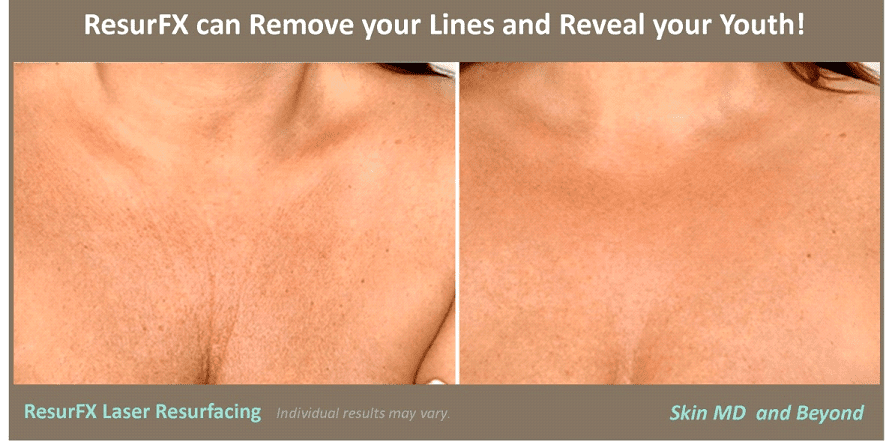 Before & After image of Neck Treatments Frisco TX