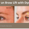 The Mini EYEBROW LIFT