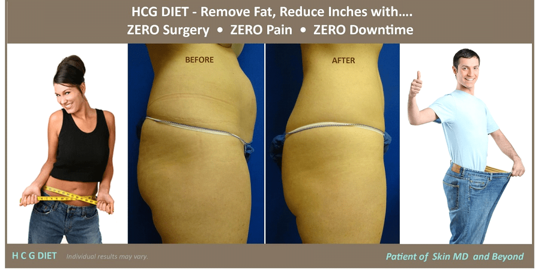 Before & After Image of Weight Management Plano TX