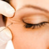 EYE REJUVENATION