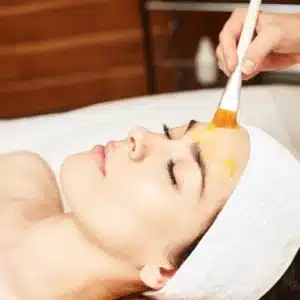 chemical peel