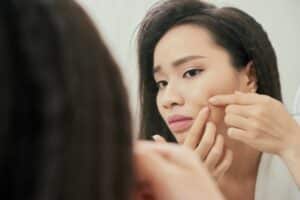 Acne Treatments – Plano and Frisco TX