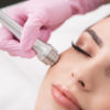 MICRONEEDLING Plano and Frisco TX