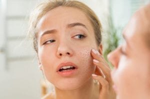 DRY SKIN Plano and Frisco TX