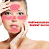 Rosacea