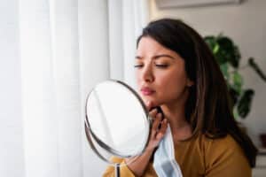 Woman looks at scarring in the mirror after acne outbreak.