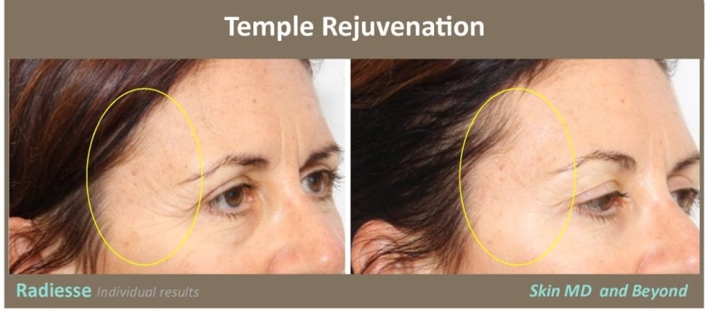 temple-rejuvenation